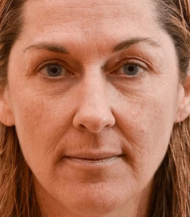 Il mio viso prima di usare la crema di eudalie