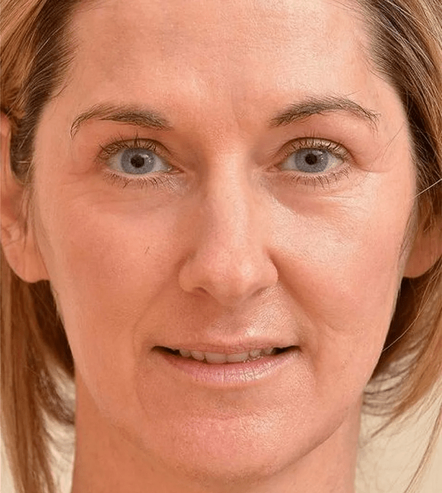 Sembro più giovane dopo aver applicato Eudalie -cream