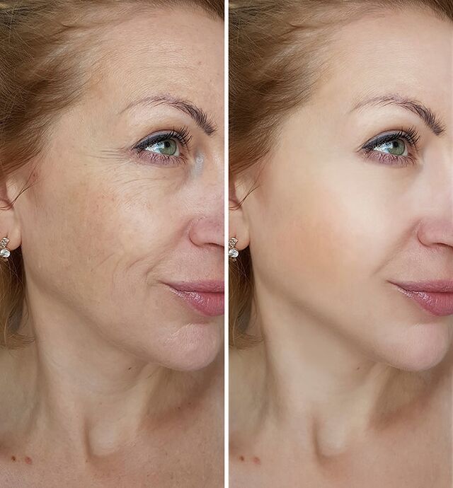 prima e dopo