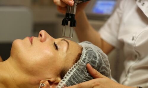 termolisi frazionata per il ringiovanimento